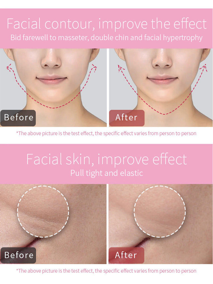 Premium EMS V-Face Massager - Face Lifting Machine for Chin Lift, Facial Slimming & Skin Tightening with Anti-Wrinkle