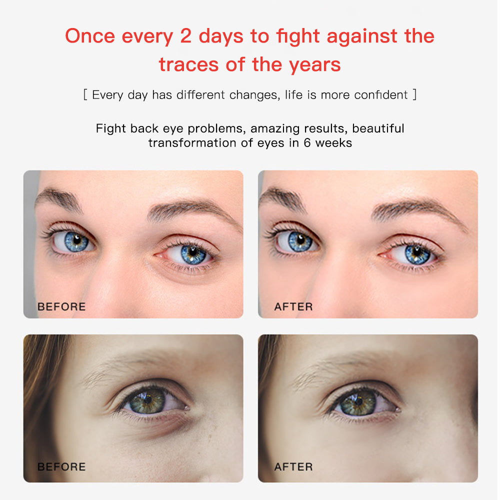 Premium 2 in 1 EMS Eye and Face Vibration Massager – Portable Electric Dark Circle Removal, Anti-Ageing Eye Wrinkle Beauty